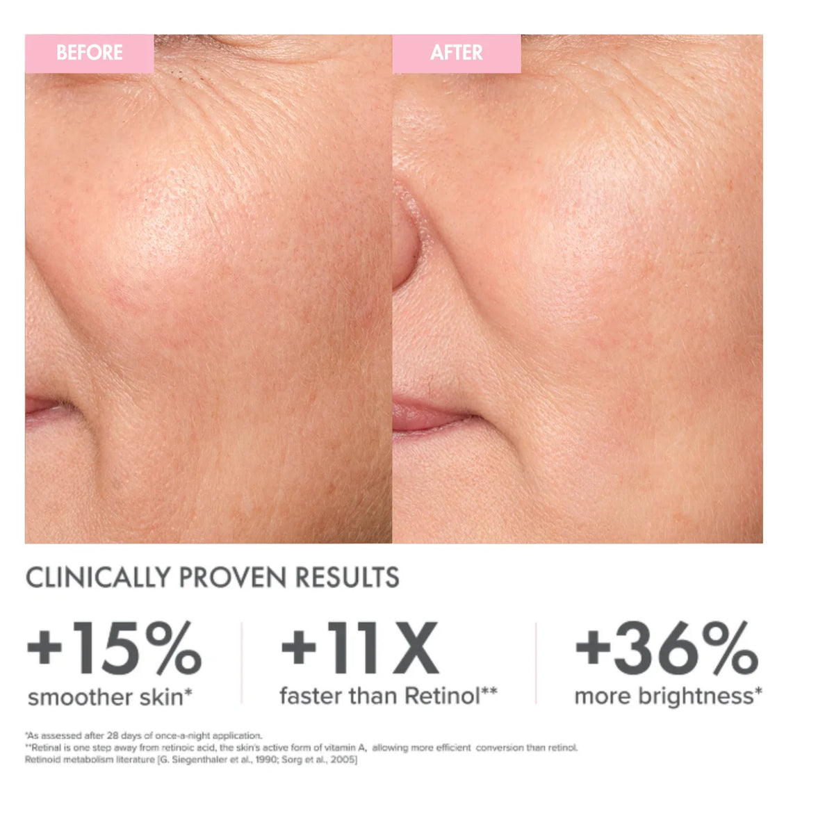 Retinal Renewal Night Serum