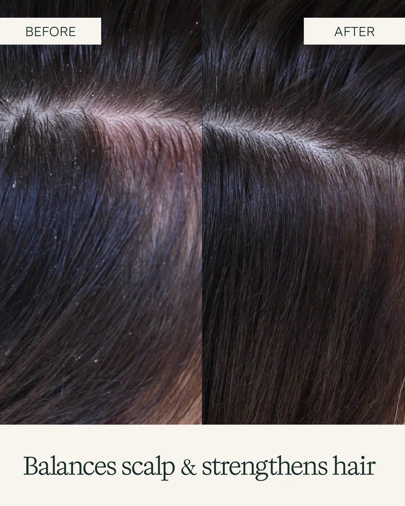Scalp Exfoliating Shampoo