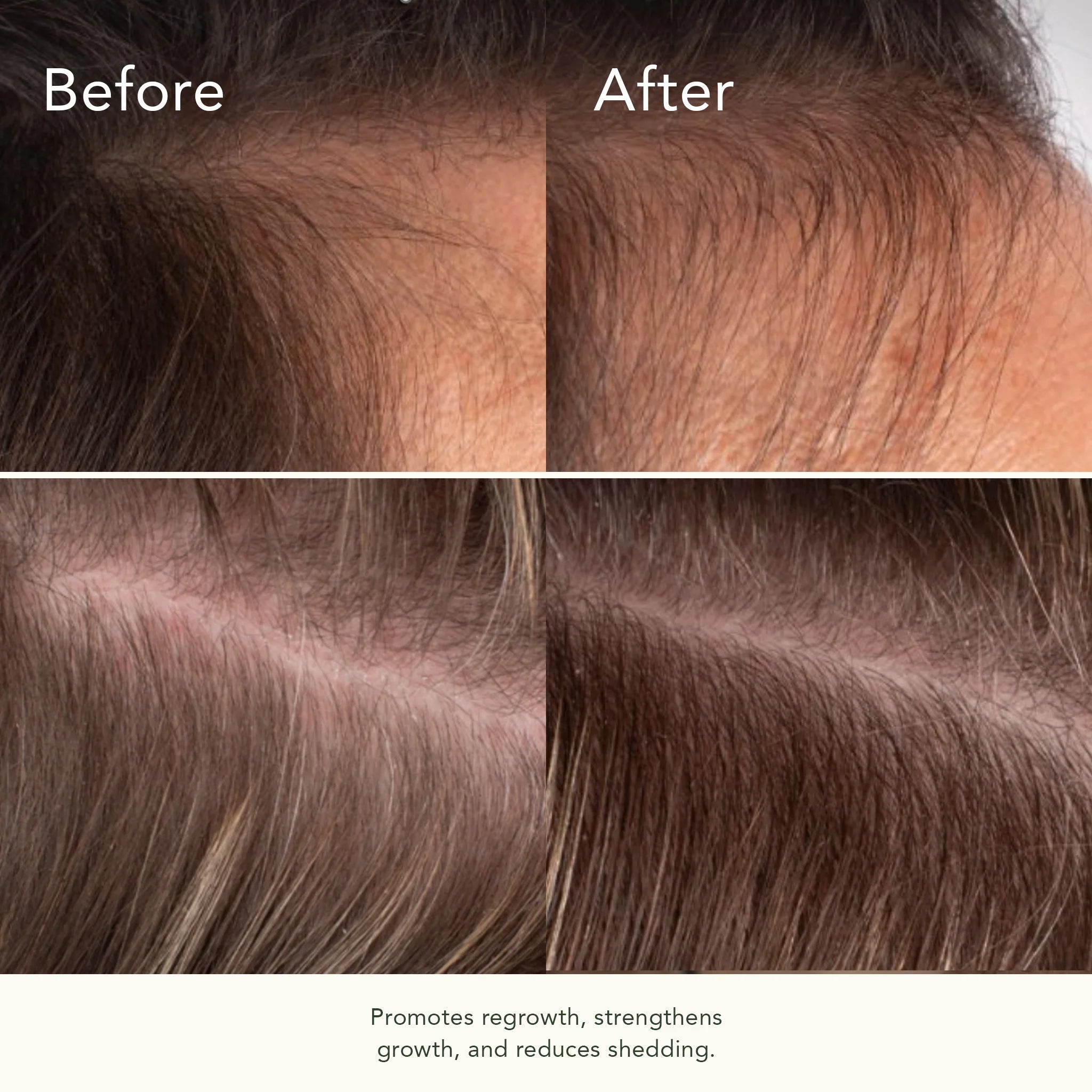 Bio-Ferment Scalp &amp; Hair Treatment - Serum für Kopfhaut &amp; Haar