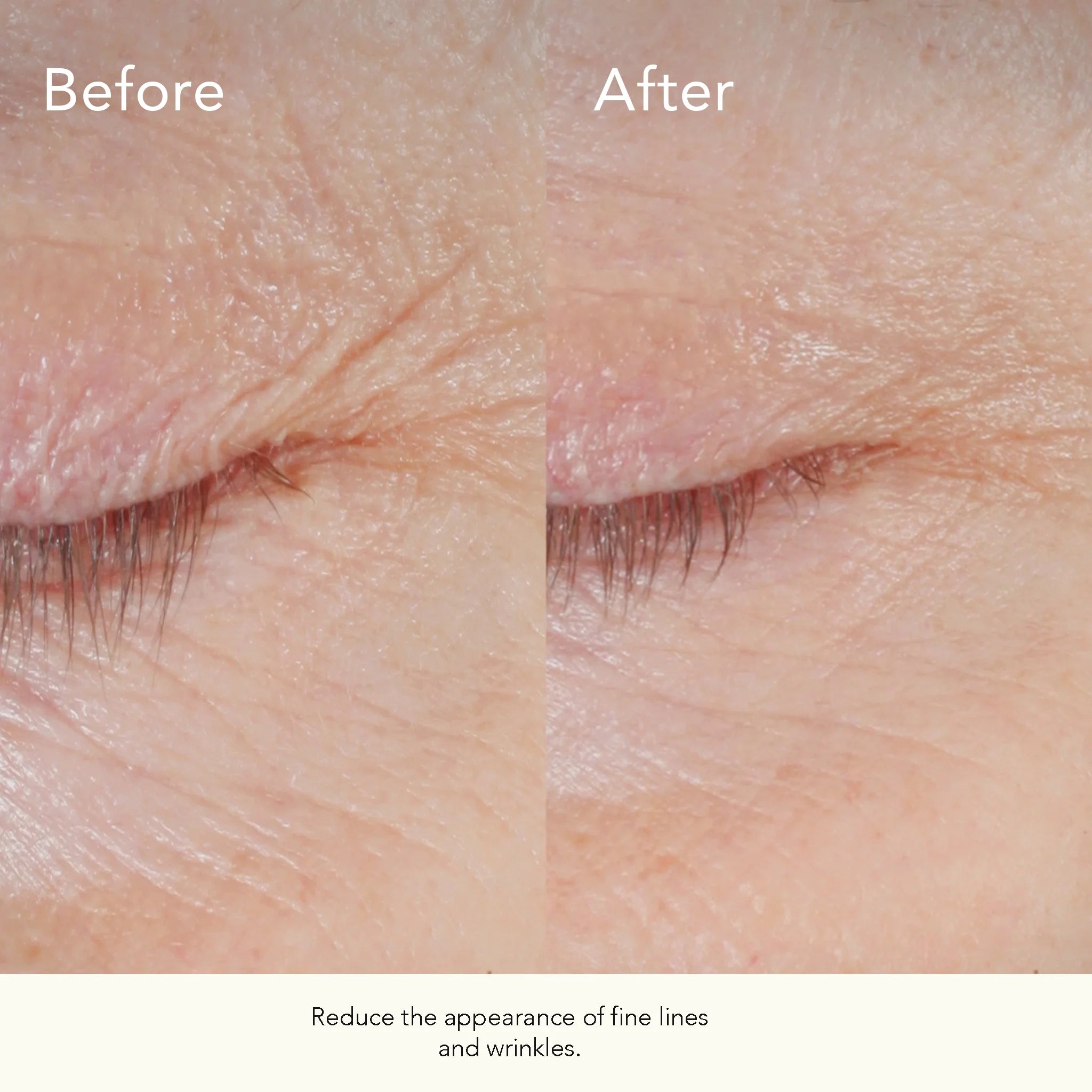 Kat Burki ﻿Form Control™ Marine Collagen Gel