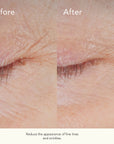 Kat Burki ﻿Form Control™ Marine Collagen Gel
