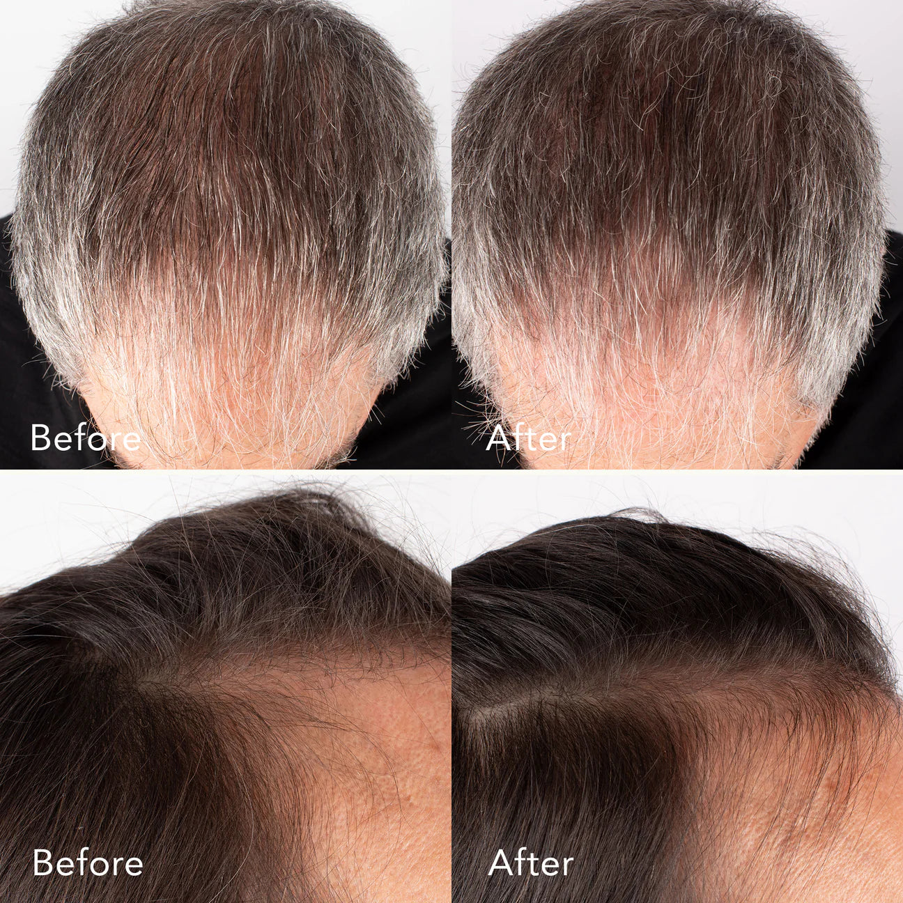 Kat Burki Bio-Ferment Renewing Conditioner - Pflegt Kopfhaut &amp; Haar für Volumen und strahlenden Glanz